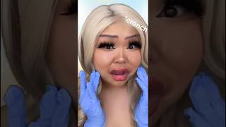 ASMR Botox Gone WRONG ‼️‼️ asmr tingly [upl. by Lichtenfeld]