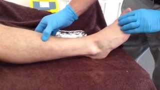 DryNeedling Extensor Hallucis Longus [upl. by Mosier]