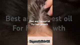 Natural Hair Regrowth Oil haircare hair hairoil beauty viralvideo viralbeauty [upl. by Yenroc]