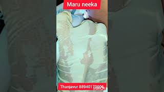 Wart Removal Thanjavur hashni parlour [upl. by Komsa]