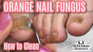 Pedicure for Men How to Clean Orange Nail Fungus Off Toenails [upl. by Mahon]