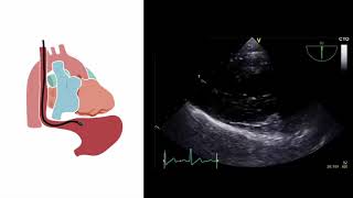 Mastering important TEE views transesophageal echocardiography [upl. by Ernestus]