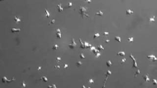 Human T cell migration on ICAM1 [upl. by Granniah]