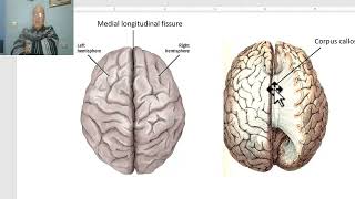 Anatomy for applied medical scienceRadiology Department 7 Dural venous sinuses by DrWahdan [upl. by Naleek]