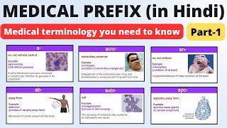 Medical prefix  medical terminology you need to know  in Hindi  pharmadice [upl. by Enitsirk717]