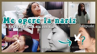 ME OPERÉ LA NARIZ  mi RINOPLASTIA día con día [upl. by Shandie]