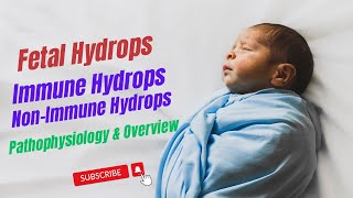 Fetal Hydrops Immune Hydrops NonImmune Hydrops Hydrops fetalis Robbins Pathology Chapter 7 [upl. by Micheline436]