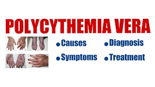 Polycythemia Vera  overview causes symptoms diagnosis treatment prognosis all explained [upl. by Wilkison]