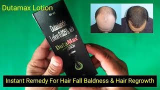 इसे लगालो 7 दिनों में लौट आएंगे लहराते बाल गंजेपन से मिलेगा छुटकारा Dutamax Lotion Honest Review [upl. by Warford]