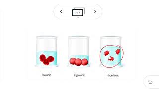 Cytology 6 osmosis  tonicity [upl. by Tychonn]