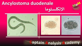 Ancylostoma duodenale  Hookworm الديدان الخطافية واذاى بتسبب انيميا نقص الحديد [upl. by Callan]