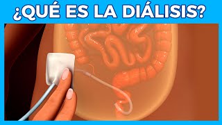 DIALISIS PERITONEAL 💊 Que es la dialisis  Junica IRC [upl. by Alic872]