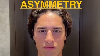 How to fix asymmetry looksmaxxing jawline asymmetry [upl. by Leasim]