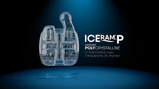 Iceram P  Orthometric [upl. by Elocal529]