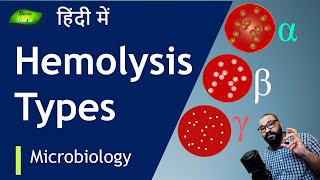 समझें Hemolysis कितनी तरह की होती है   Basic Science Series Hindi [upl. by Noiro]