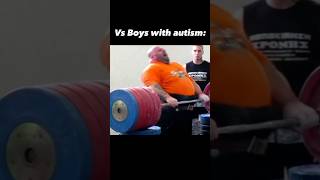 Girls with autism vs boys with autism [upl. by Aernda158]