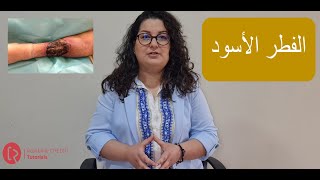 Mucormycosis or Black Fungus  الفطر الأسود الأعراض الأسباب والعلاج الوقاية [upl. by Mian]