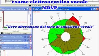 CORDECTOMIA RIABILITAZIONE [upl. by Nodmac274]