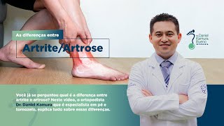 O que é artrite O que é artrose  Causas sintomas e dicas [upl. by Novahs]