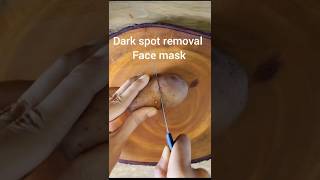 How to remove dark spots from face naturally at home👈🍓shortsviews shortsfeed tranding [upl. by Larimor]