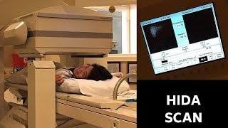 MY HIDA SCAN EXPERIENCE [upl. by Ardnuassac]