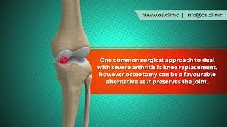 What is an knee osteotomy [upl. by Aleras]