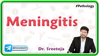 4 Meningitis  USMLE Step 1 Pathology [upl. by Aserehtairam302]