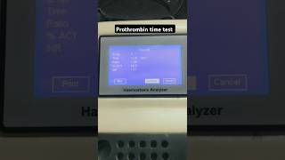 Prothrombin time test  Coagulation test  PT test  INR test  APTT test labtechnician dmlt [upl. by Broeker391]