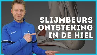 Slijmbeursontsteking Hiel Ontdek de oplossing [upl. by Erb]