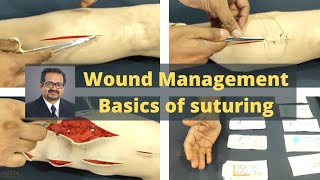 Wound Management  Basics of suturing  How to hold surgical instruments [upl. by Garald]