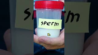 Is Protein Powder Decrease your Sperm count shorts youtubeshorts spermcount drhealth [upl. by Nael570]