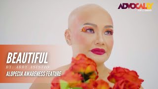 Advocally Concert  Abby Asistio  Beautiful  Alopecia Philippines Feature [upl. by Enyledam456]