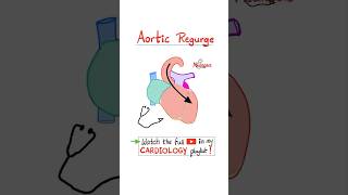 Aortic Regurgitation AR  Valvular Heart Disease VHD…biology science cardiology anatomy [upl. by Ludovika704]