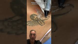 Laser Tattoo Removal [upl. by Aynotak]