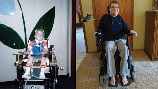 Starting 39th Year of Quadriplegia [upl. by Fremont]