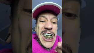 Grillz no dente [upl. by Mel]