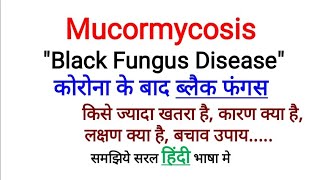 Mucormycosis  Black Fungus  Symptoms Prevention Diagnosis Treatment amp Risk Factor  In Hindi [upl. by Mellins]