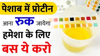 पेशाब में प्रोटीन आज ही ख़तम करे  Peshab mein jalan ka ilaj  Kidney Treatment In Ayurveda [upl. by Windsor788]