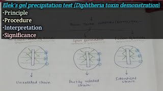 Eleks gel precipitation test  Principle  Procedure  Results  Interpretation  Significance [upl. by Yvette560]