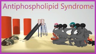 Antiphospholipid Syndrome Mnemonic for the USMLE [upl. by Nitin]