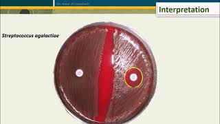 Bacitracin test for Streptococcus pyogenes [upl. by Wan]