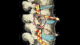 Suffering with armhand or legfoot numbness or tingling [upl. by Philender]