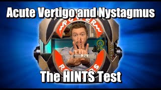 Acute Vertigo and Nystagmus HINTS Test [upl. by Milford376]