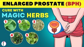 🔥 Magic Herbs to Cure Enlarged Prostate  Prostate enlargement Treatment  BPH Treatment [upl. by Heber1]