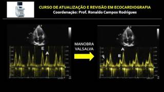 DIRETRIZ ASEEACI 2016  ESTUDO DA FUNÇÃO DIASTÓLICA DO VENTRÍCULO ESQUERDO [upl. by Ion896]