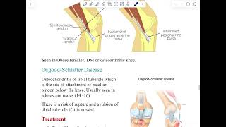 Soft Tissue Rheumatism  P2 [upl. by Sicnarf]