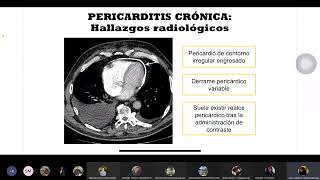 Sesión 6  Pericarditis y Cardiopatía valvular  Diagnóstico por imágenes 1  020420226 [upl. by Trimble]