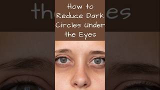 💯Reduce dark circles just 3 daysDarkcircles skincare viralshorts youtubeshortsvideo [upl. by Masry]