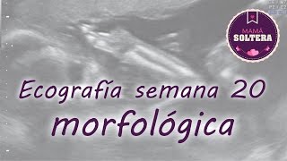 Ecografía morfológica semana 20 de embarazo [upl. by Eniamahs]