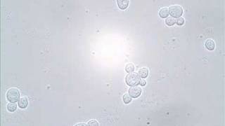 Budding and Shmooing  Yeast Reproduction [upl. by Leora]